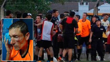 El árbitro recibió golpes y patadas en Ayacucho