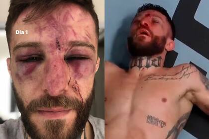 El argentino Marcelo Rojo sufrió una durísima derrota en UFC