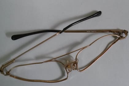 El armazón de los lentes apareció completamente doblado