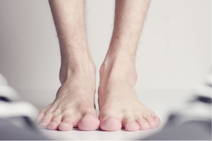 El ataque agudo típico afecta con inflamación y dolor a los pies