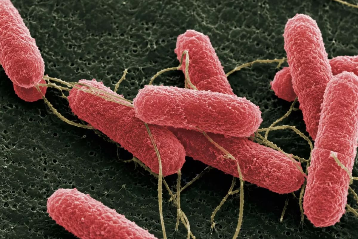 ‘Resultados encorajadores’: Uma nova molécula pode reduzir a carga de uma bactéria que causa uma doença que afecta particularmente as crianças