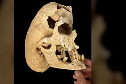 El caballero medieval tenía una rara condición genética