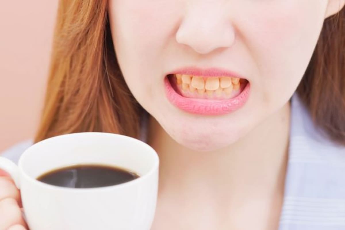El café contiene taninos que pueden manchar los dientes
