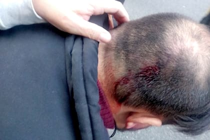 El camarógrafo de LN , Fabio Soria, fue agredido y herido durante la manifestación