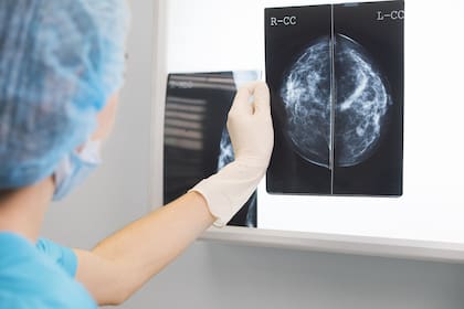 El cáncer de mama es el más frecuente en la Argentina