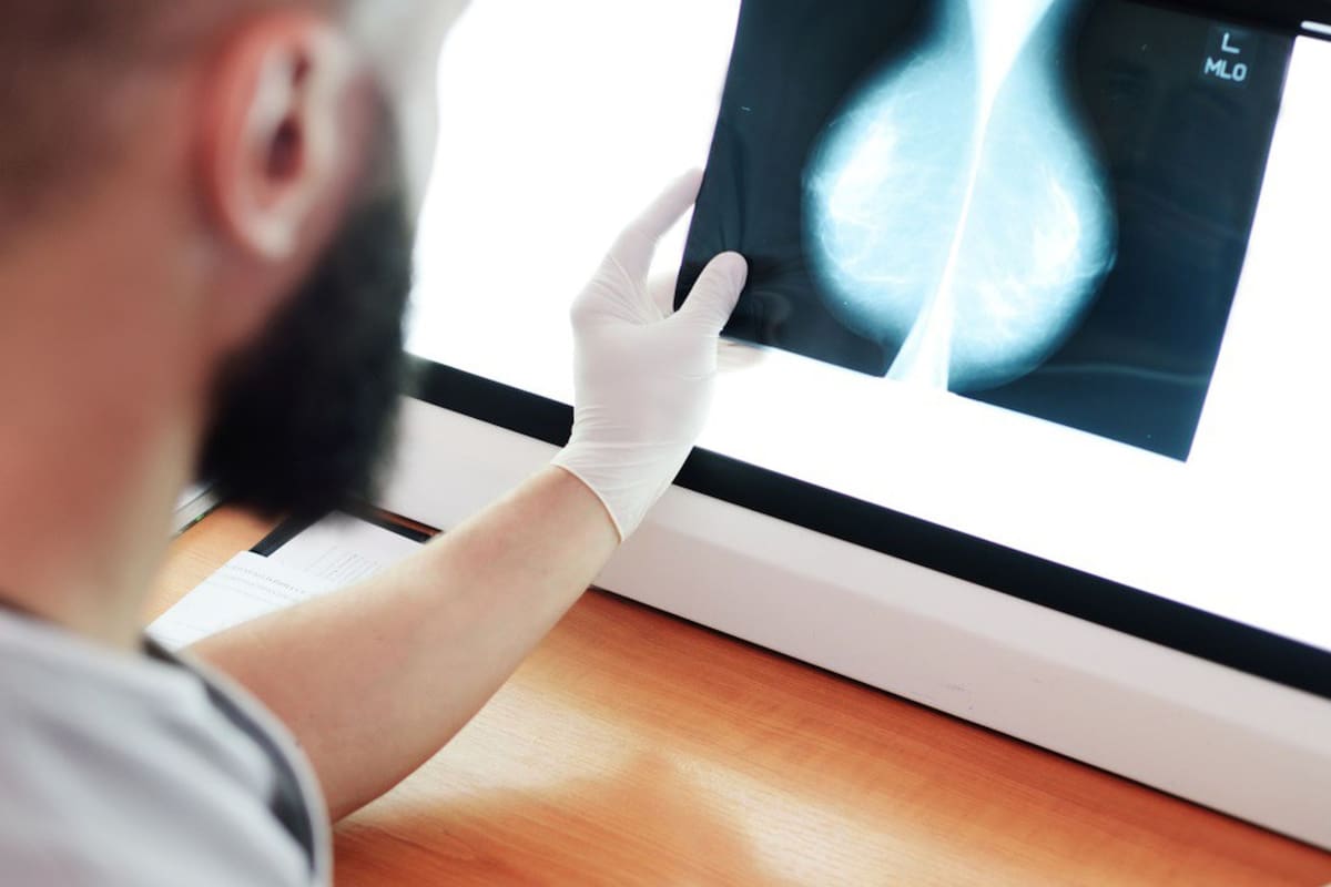 El cáncer de mama, uno de los más frecuentes