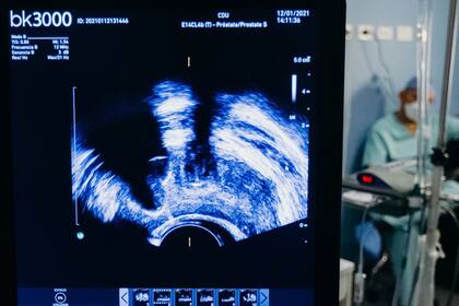 El cáncer de próstata es absolutamente tratable, para el que existe un abanico de técnicas terapéuticas y prácticas innovadoras con tecnología de punta para frenarlo.