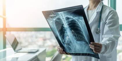 El cáncer de pulmón es el que más muertes genera en la Argentina