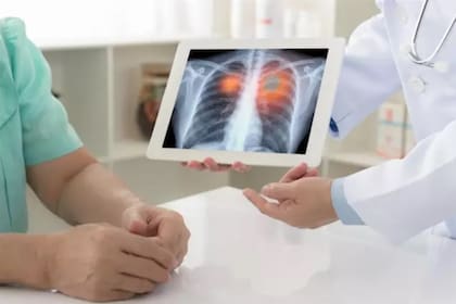 El cáncer de pulmón también puede ser hereditario