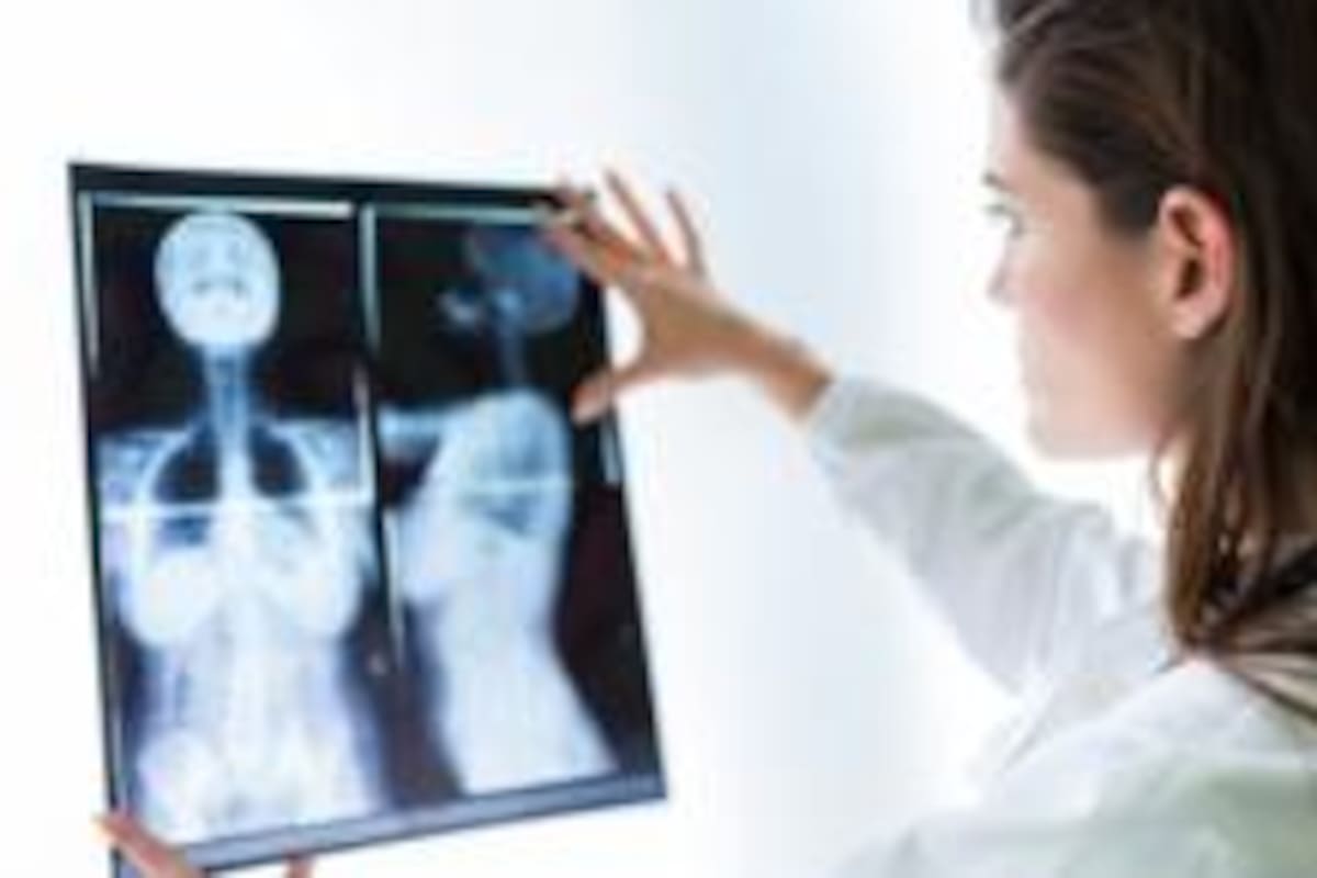 El cáncer inflamatorio de mama es el más raro de este tipo de carcinomas.