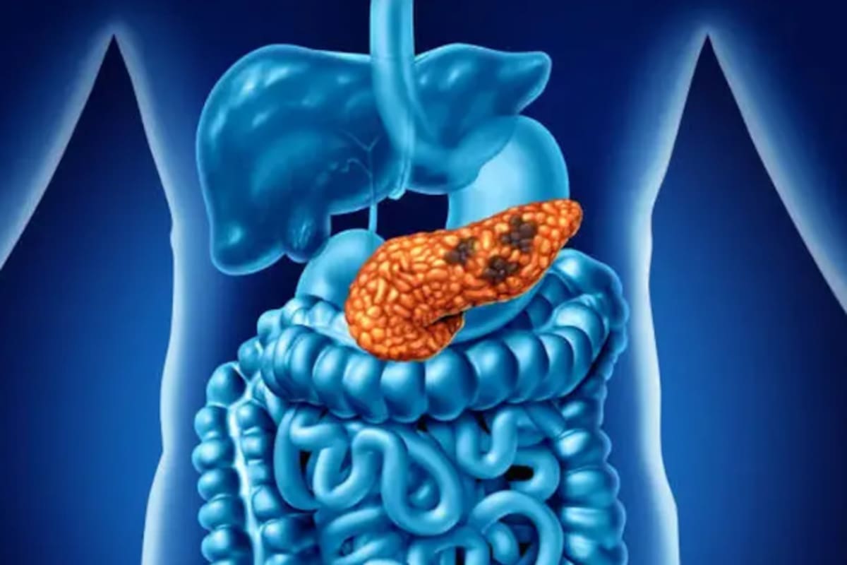 “El cáncer multiplica y multiplica sus células. Entonces, siempre tiene una vía de escape”, explicó Tartaglione