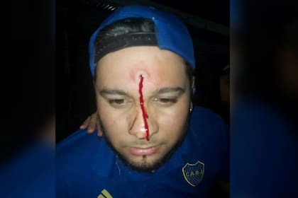 El cantante de cumbia "Yeison y el after", Esteban de Jesús Vallejos