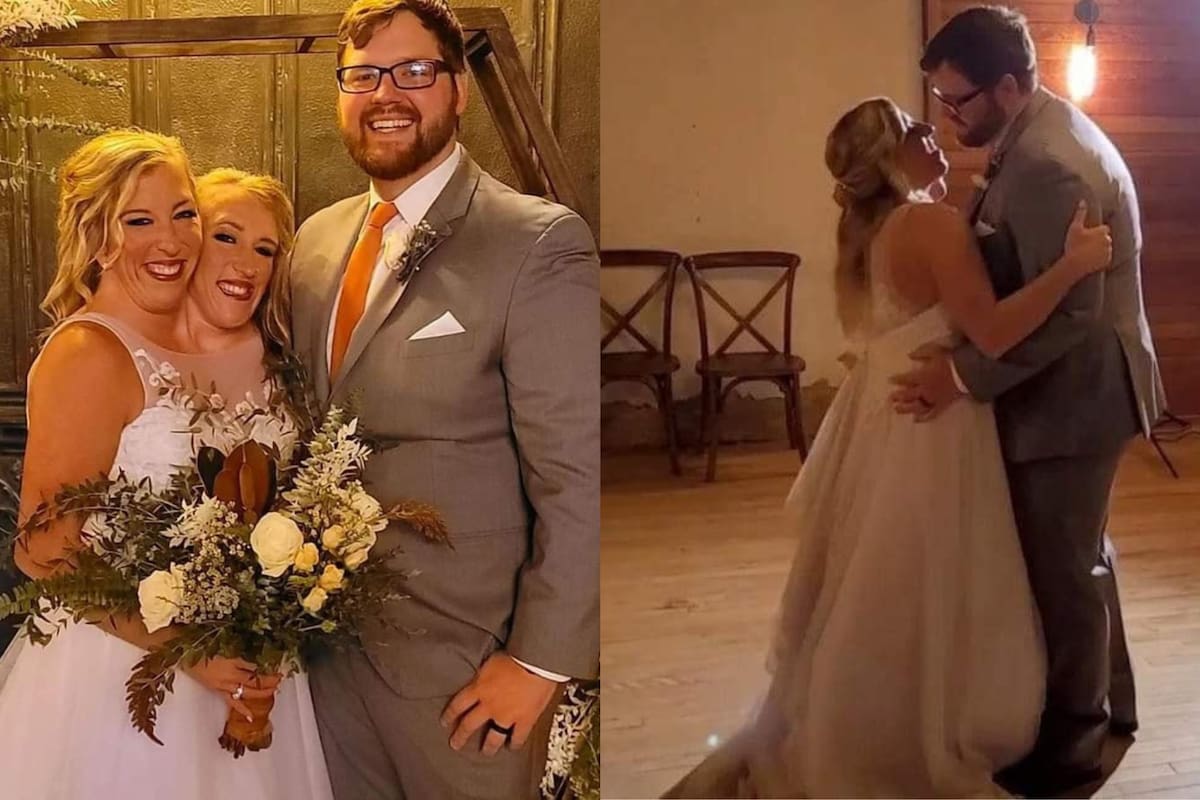 El casamiento de Abby Hensel y Josh Bowling fue mediático