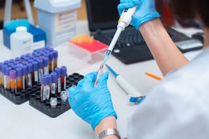 El caso de "Esperanza" podría ser clave para la aparición de nuevos tratamientos contra el HIV.