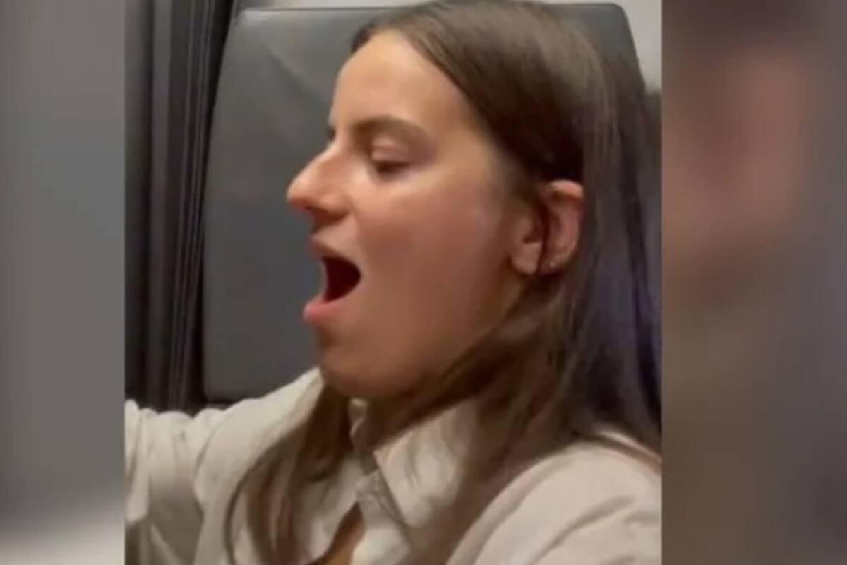 El caso de Isabella, una joven que sufrió una lesión en su mandibula en pleno vuelo
Foto: @bxllajames