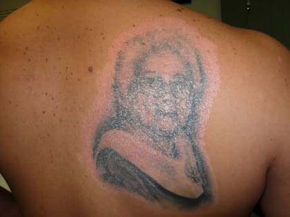 El caso de un hombre con diagnóstico de psoriasis, que se tatuó a su abuela y luego de 4 meses empezó a presentar lesiones en esa zona
