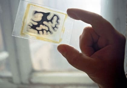 El cerebro de Lenin fue rebanado en más de 30.000 partes y estas fueron colocadas en placas de vidrio y algunas fueron bañadas con tintes para estudiarlas. En la década de los 90 las muestras fueron exhibidas a la prensa.