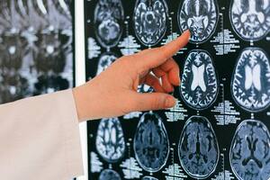 El cerebro envejece, al igual que el resto del cuerpo; en ese proceso, ciertos olvidos leves hacen parte de la normalidad