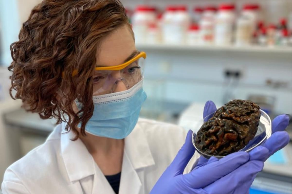 El cerebro es quizás el más blando de los tejidos blandos del cuerpo