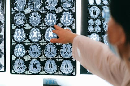 El cerebro (explicó) tiende a automatizar patrones para ahorrar energía, incluso si estos generan malestar