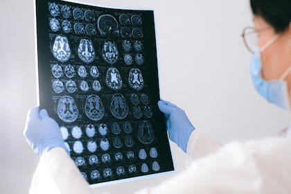 el cerebro humano cuenta con un complejo mecanismo de conexiones neuronales (imagen ilustrativa)