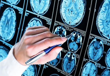 El cerebro tiene una notable plasticidad que le permite adaptarse y cambiar a lo largo de la vida