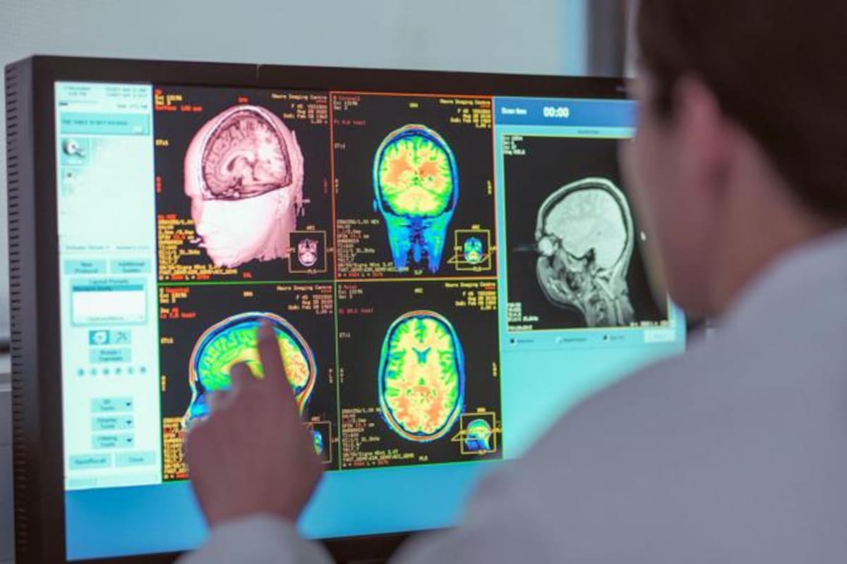 El cerebro tiene varios puntos de inflexión a lo largo de los años.