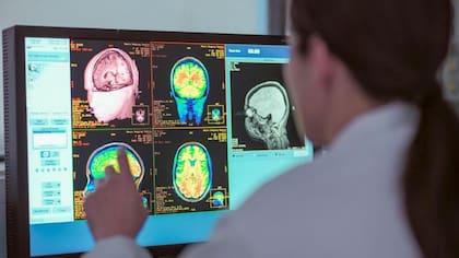 El cerebro tiene varios puntos de inflexión a lo largo de los años
