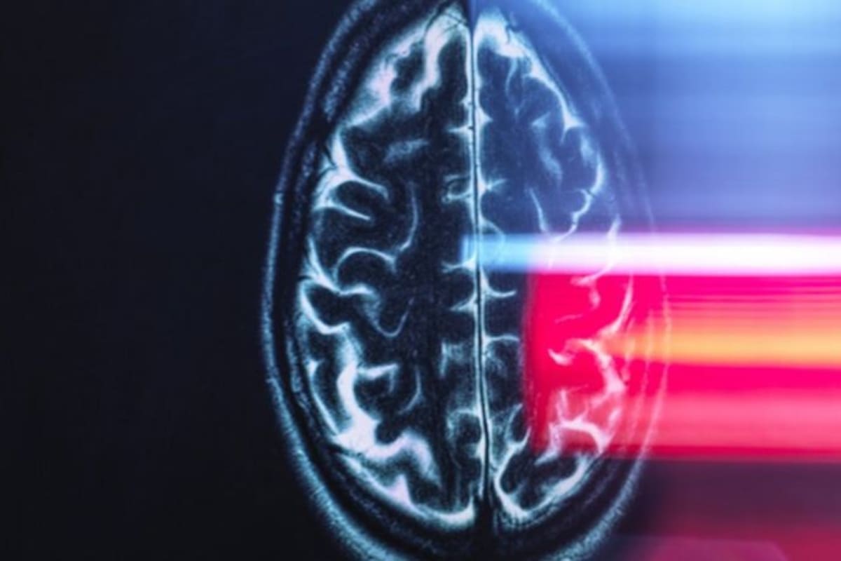 El cerebro: todo un misterio