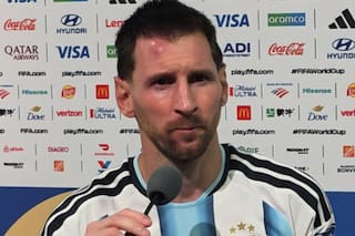 El chichón de Messi: así le quedó la frente tras chocar contra la rodilla de un rival