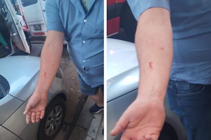 El chofer de la línea 64 resultó con heridas cortantes en los brazos