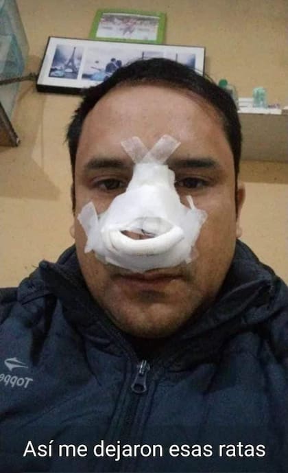El chofer debió ser operado y se encuentra en reposo a raíz del golpe