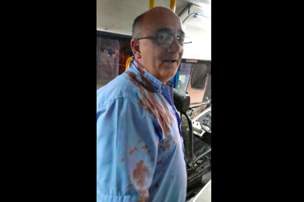 El chofer que fue agredido anoche.