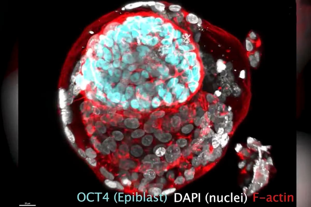 El científico palestino Jacob Hanna logra imitar por primera vez una de las fases más desconocidas del desarrollo embrionario de una persona