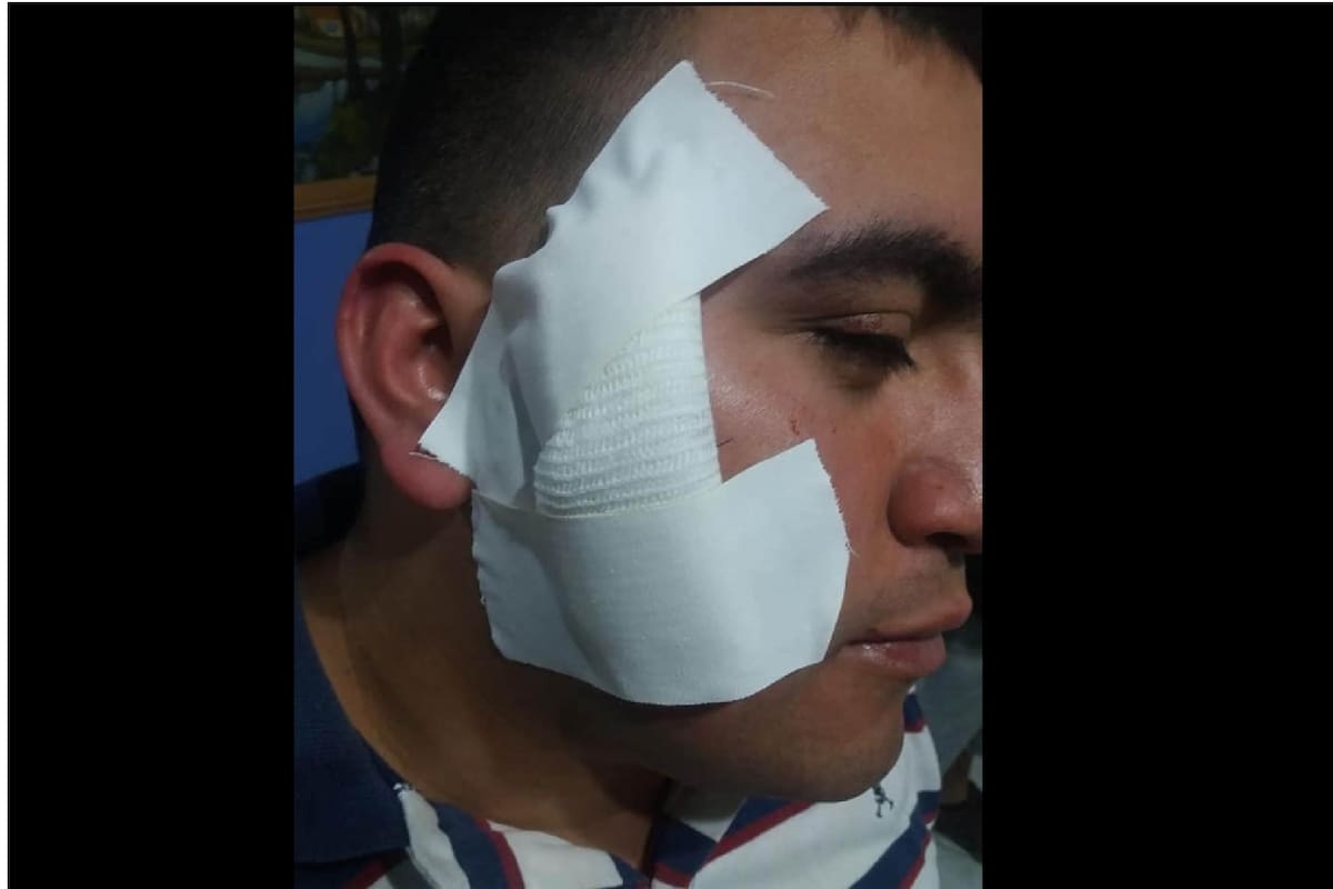 El colectivero acuchillado en González Catán