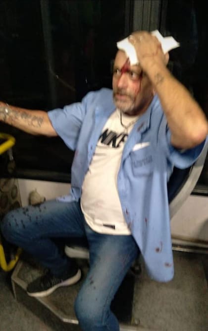 El colectivero golpeado en Grand Bourg