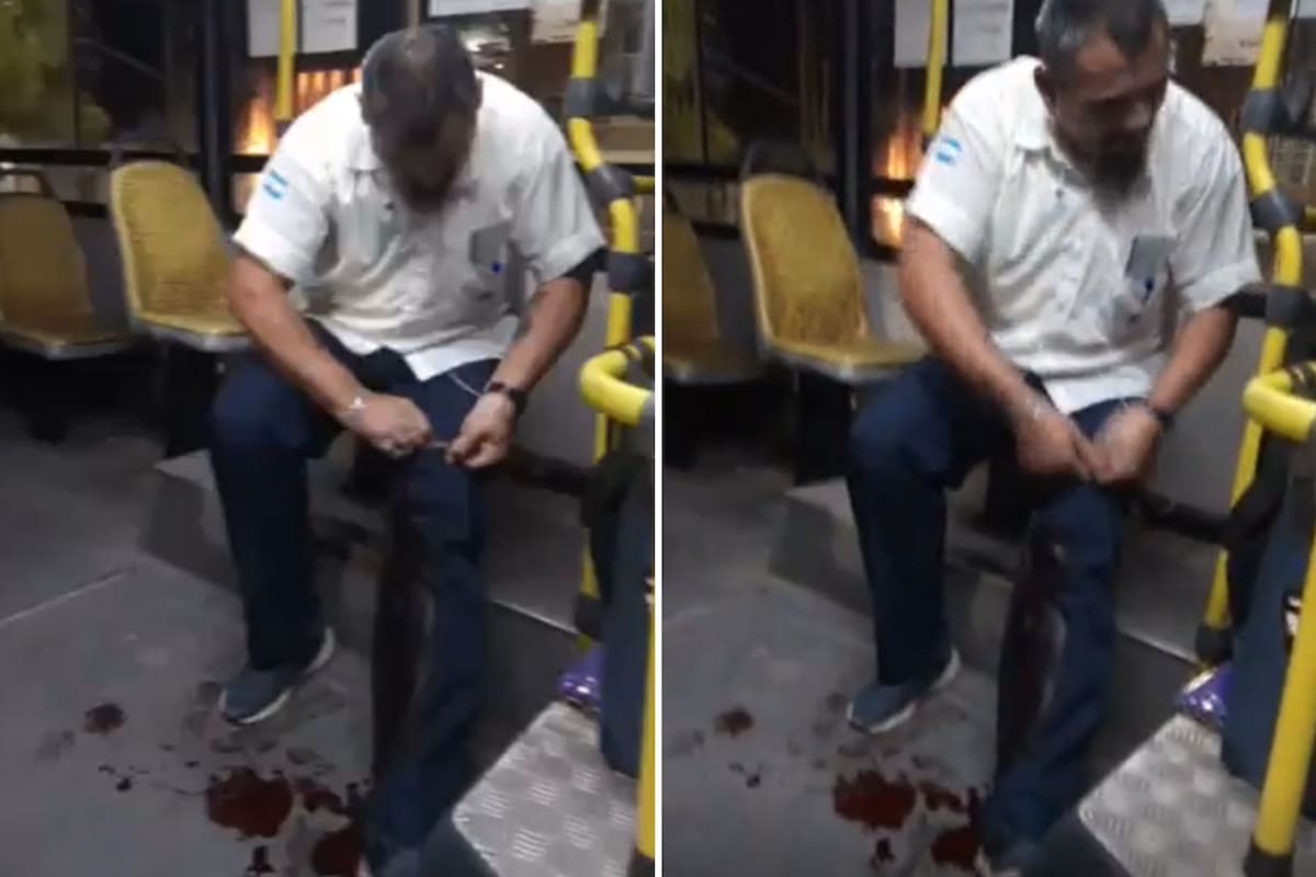 El colectivero tiroteado en Escobar