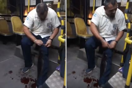 El colectivero tiroteado en Escobar