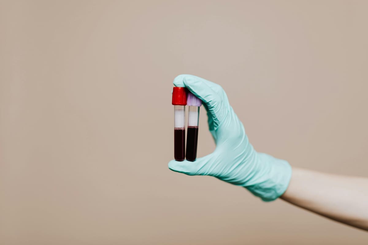 El colesterol es un problema de salud creciente en el mundo que afecta a un gran porcentaje de la población