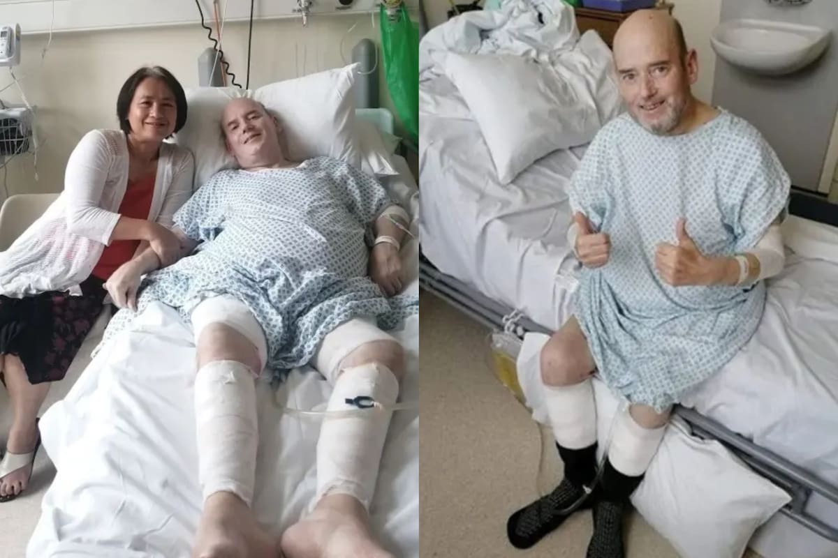 El corazón de Kevin Hill dejó de latir durante varios minutos luego de complicaciones de una operación de válvula cardíaca el año pasado