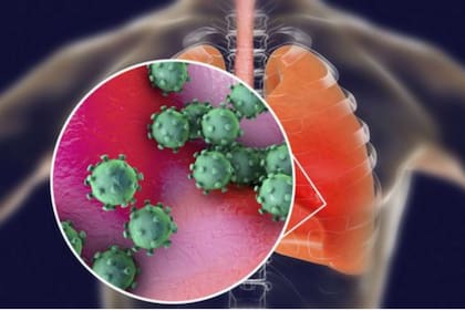 El coronavirus puede causar lesiones severas en los pulmones