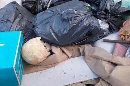El cráneo hallado dentro de un contenedor en Leandro N. Alem al 4900, cerca de Playa Grande, en Mar del Plata