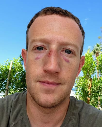El creador de Facebook, ahora Meta, subió una foto en su cuenta de Instagram donde se ve con moretones
