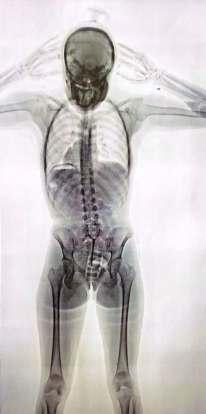 El cuerpo de la "mula", según el escáner del aeropuerto internacional de Ezeiza