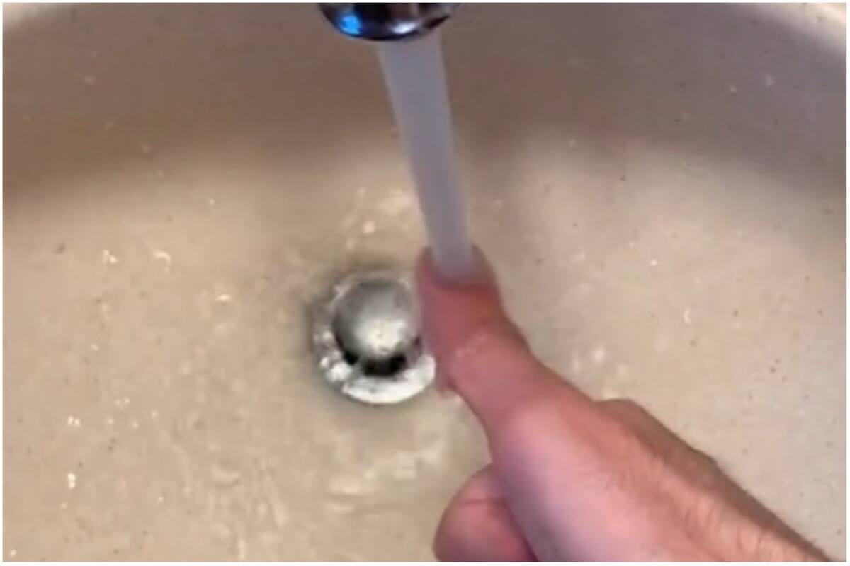 El dedo de un chico de Estados Unidos que lo comparan con E.T.
Foto: captura de pantalla