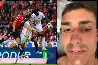 Le fracturaron la nariz, recibió 7 puntos, no cobraron penal y lo expulsaron