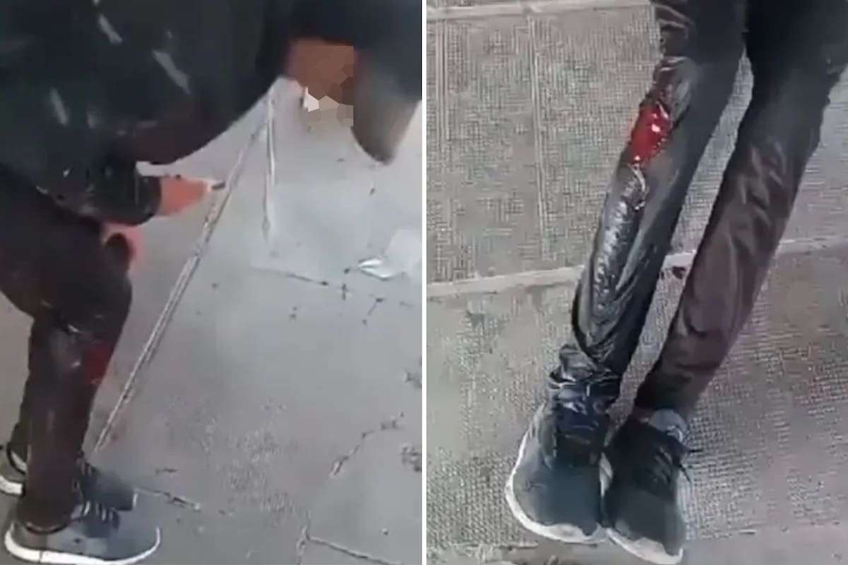 El delincuente se dio a la fuga, pero más tarde fue arrestado; el menor está internado, fuera de peligro