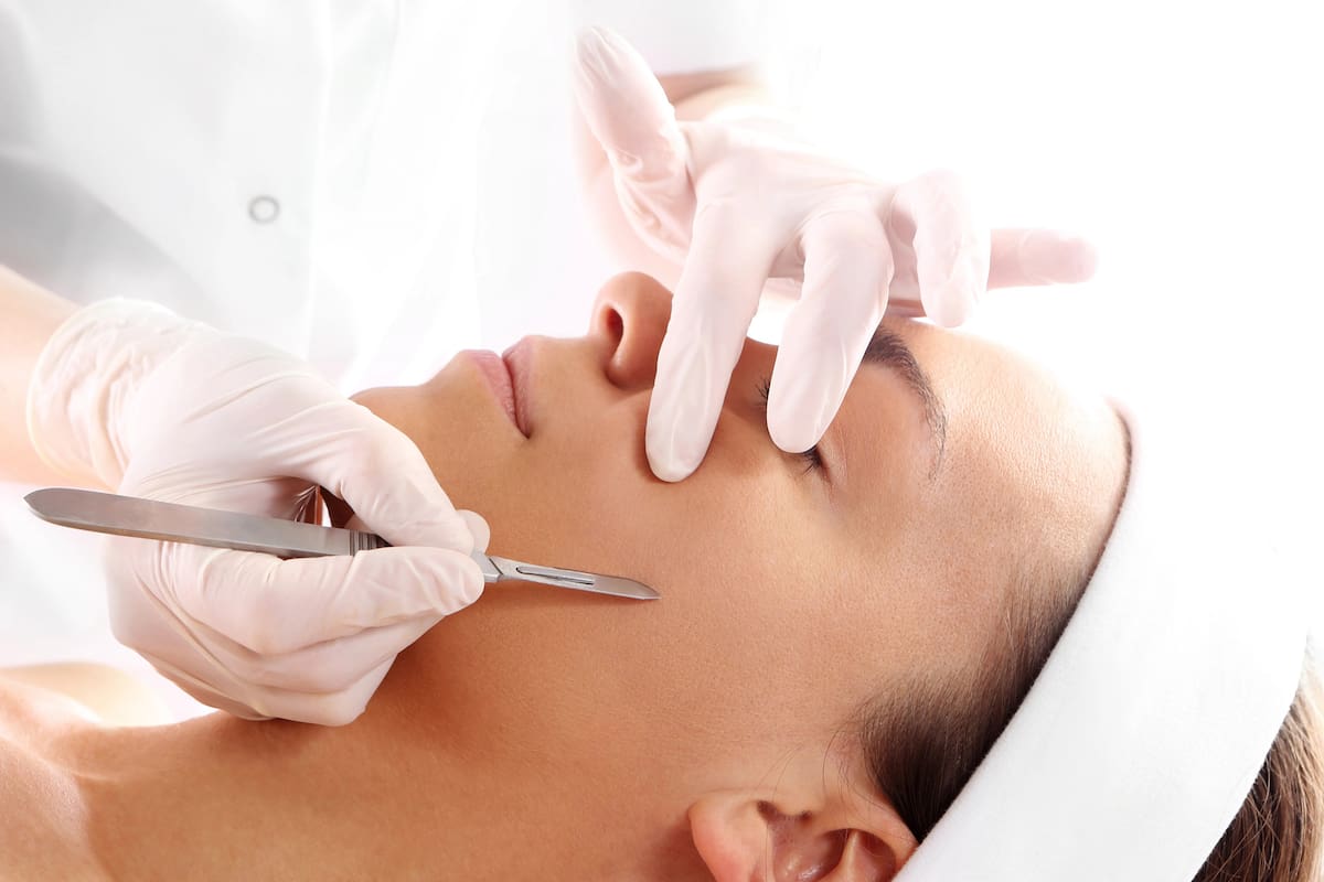 El dermaplaning se realiza con un bisturí quirúrgico especial que permite un afeitado más preciso que una navaja convencional (Crédito: Self.com)