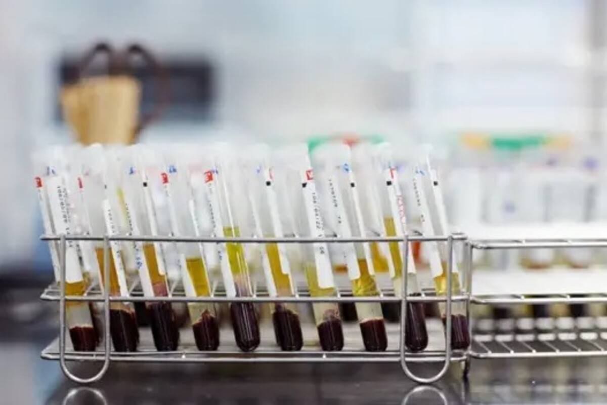 El descubrimiento de un nuevo grupo sanguíneo, denominado MAL, ha resuelto un enigma que llevaba sin respuesta más de 50 años (Archivo)