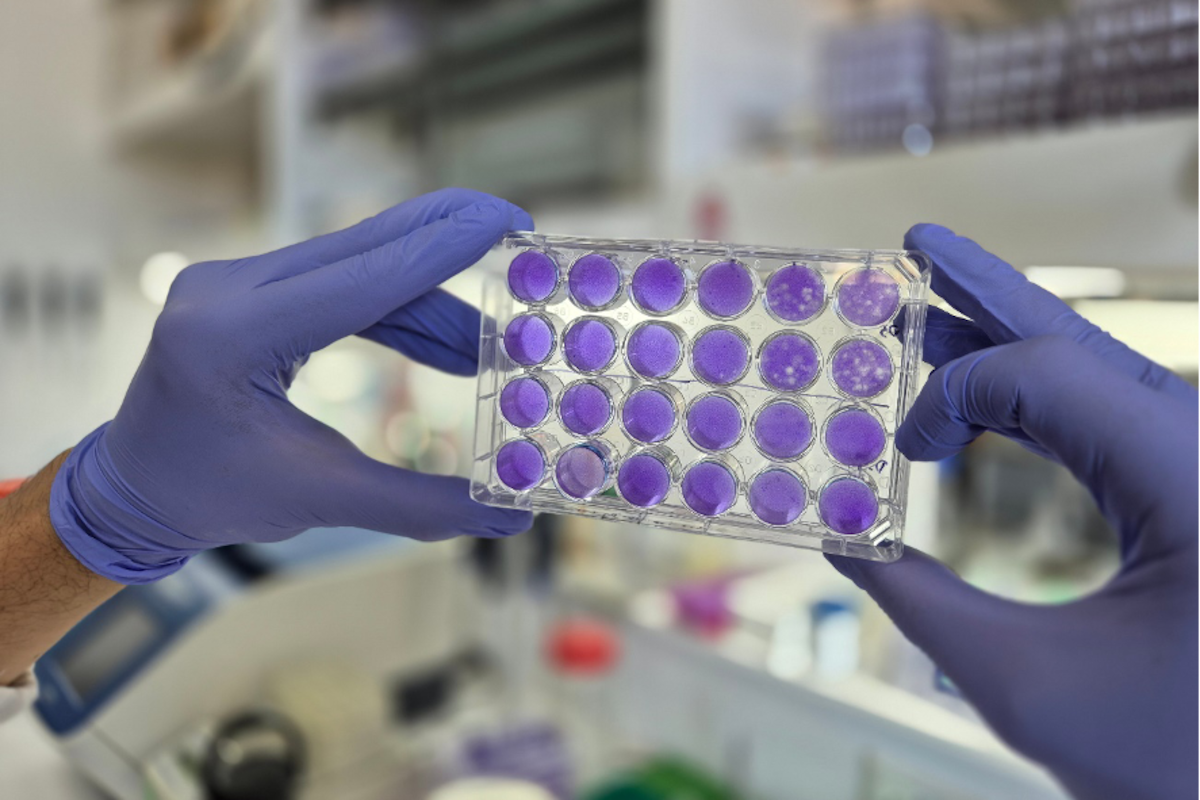 El descubrimiento tiene relevancia porque, hasta ahora, desarrollar antivirales contra este tipo de patógenos representaba un gran desafío
